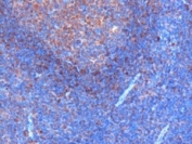 IHC staining of FFPE human tonsil with GRB2 antibody at 0.3ug/ml.  HIER: microwaved with pH6 citrate buffer, HRP-staining.