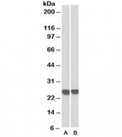 Western blot  of MOLT4 (A) and human thymus (B) lysates with GRB2 antibody at 0.3ug/ml. Predicted molecular weight ~25kDa. An NAP blocker was used in place of non-fat milk as blocking solution and diluent. (1)
