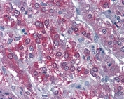 IHC staining of FFPE human adrenal gland with CAMK2A antibody at 3.75ug/ml. HIER: steamed with pH6 citrate buffer, AP-staining.