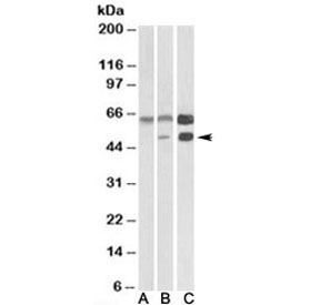 Western blot testing of human cerebellum [A], mouse brain [B], and rat brain [C] lysates with CAMK2A antibody at 0.3ug/ml. Predicted molecular weight: ~54kDa. An additional ~65kDa band is often observed.