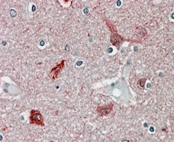 IHC staining of FFPE human brain cortex with CAMK2A antibody at 4ug/ml. HIER: steamed with pH6 citrate buffer, AP-staining.