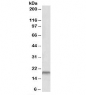 Western blot testing of human placenta lysate with SPINT2 antibody at 0.3ug/ml. Predicted molecular weight: ~22kDa.