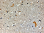 IHC testing of FFPE human brain with NOS1AP antibody at 4ug/ml. HIER: steamed with pH9 Tris/EDTA buffer, HRP-staining.