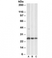 Western blot testing of human [A], mouse [B] and rat [C] heart lysates with DUSP6 antibody at 0.3ug/ml. Predicted molecular weight ~42/26kDa (isoforms a/b).