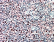 IHC staining of FFPE human tonsil with PSMB10 antibody at 5ug/ml. HIER: steamed with pH6 citrate buffer, AP-staining.