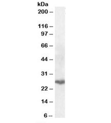 Western blot testing of human lung lysate with PSMB10 antibody at 0.3ug/ml. Predicted molecular weight: ~29kDa.~