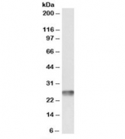 Western blot testing of human heart lysate with MT-ATP6 antibody at 0.1ug/ml. Predicted molecular weight: ~25kDa.