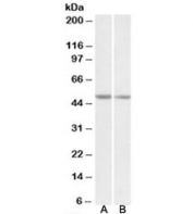 Western blot of mouse brain (Lane 1) and rat brain (lane 2) lysates with GNAS antibody at 0.1ug/ml. Predicted molecular weight ~46/111kDa (mouse & rat isoforms GNASL/XLas).