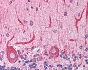 IHC testing of FFPE human cerebellum tissue with BAP31 antibody at 3.75ug/ml. Required HIER: steamed antigen retrieval with pH6 citrate buffer; AP-staining.