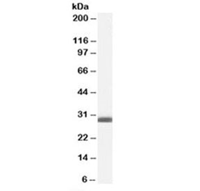 Western blot testing of human breast lysate with BAP31 antibody at 0.1ug/ml. Predicted molecular weight: ~28kDa.