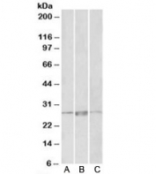 Western blot testing of human heart lysate with PRRX1 antibody at 1ug/ml. Predicted molecular weight: ~27kDa.
