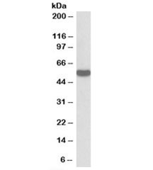 Western blot testing of HeLa lysate with HSPC117 antibody at 0.3ug/ml. Predicted/observed molecular weight: ~55kDa.~