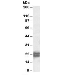 Western blot testing of human testis lysate with NPC2 antibody at 0.5ug/ml. Predicted molecular weight: ~17kDa, can be observed as a ~21/23kDa doublet in human samples. (Ref 1)