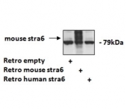 stained after retrovirally overexpressing Mouse Stra6 and not after overexpressing Human Stra6