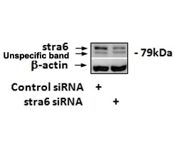 Western blot testing of siRNA-mediated STRA6 expression in 3T3-L1 lysate with STRA6 antibody at 1.7ug/ml.~