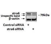 Western blot testing of siRNA-mediated STRA6 expression in 3T3-L1 lysate with STRA6 antibody at 1.7ug/ml.