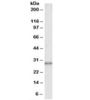 Western blot testing of human liver lysate with CA1 antibody at 0.03ug/ml. Predicted/observed molecular weight: ~29kDa.