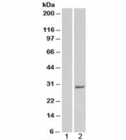 Western blot of HEK293 lysate overexpressing human STX6 probed with Syntaxin 6 antibody (mock transfection in lane 1). Predicted molecular weight: ~29kDa.