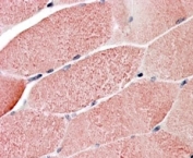 IHC staining of FFPE human skeletal muscle with TRIM7 antibody at 4ug/ml. HIER: steamed with pH6 citrate buffer, AP-staining.