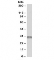 Western blot testing of human skeletal muscle lysate with TRIM7 antibody at 1ug/ml. Predicted molecular weight: ~25kDa.
