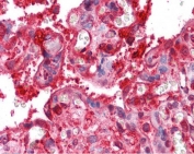 IHC testing of FFPE human placenta tissue with Radixin antibody at 2.5ug/ml. Required HIER: steamed antigen retrieval with pH6 citrate buffer; AP-staining.