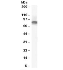 Western blot testing of human tonsil lysate with Radixin antibody at 0.03ug/ml. Predicted molecular weight: ~69kDa, routinely observed at ~82kDa (Ref 1).
