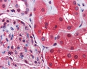 IHC testing of FFPE human kidney tissue with Radixin antibody at 2.5ug/ml. Required HIER: steamed antigen retrieval with pH6 citrate buffer; AP-staining.