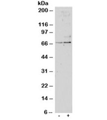 Western blot testing of untreated (left) and TGFBI-treated (right, 1ng/ml, 24hr) primary cultured human lung fibroblasts with SRF antibody at 1ug/ml. Predicted molecular weight: ~52/60-70kDa (unmodified/phosphorylated).
