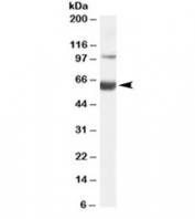 Western blot testing of human liver lysate with HNF1B antibody at 0.1ug/ml. Expected molecular weight: both the expected ~61kDa band the and additional ~100kDa band are blocked by the immunizing peptide.