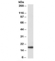Western blot testing of human liver lysate with Haptoglobin antibody at 0.01ug/ml. Predicted molecular weight: ~15-18 kDa (alpha chain).