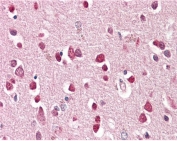 IHC testing of FFPE human brain (cortex) tissue with GRIK1 antibody at 3.75ug/ml. Required HIER: steamed antigen retrieval with pH6 citrate buffer; AP-staining.
