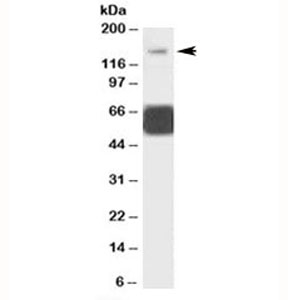 Western blot testing of human cerebellum lysate with GRIK1 antibody at 1ug/ml. Predicted molecular weight: ~104/150+ kDa (unmodified/glycosylated). Both observed bands are blocked by the addition of immunzing peptide.~