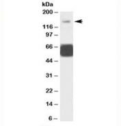 Western blot testing of human cerebellum lysate with GRIK1 antibody at 1ug/ml. Predicted molecular weight: ~104/150+ kDa (unmodified/glycosylated). Both observed bands are blocked by the addition of immunzing peptide.
