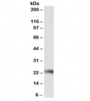Western blot testing of Jurkat lysate with CD3G antibody at 0.3ug/ml. Predicted molecular weight: ~21kDa.