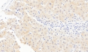 IHC staining of FFPE human liver tissue with Monoglyceride lipase antibody at 5ug/ml. Required HIER: steamed antigen retrieval with pH6 citrate buffer; HRP-staining.