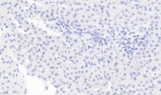 Negative control: IHC staining of FFPE human liver tissue without primary antibody. Required HIER: steamed antigen retrieval with pH6 citrate buffer; HRP-staining.