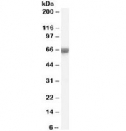 Western blot testing of human umbilical cord lysate with FOXO1 antibody at 0.1ug/ml. Predicted molecular weight ~70kDa.