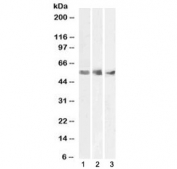 Western blot testing of human 1) spleen, 2) kidney and 3) testis lysate with WT1 antibody at 1ug/ml. Predicted molecular weight ~54 kDa.