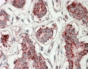 IHC staining of FFPE human breast with Aconitase 2 antibody at 3.8ug/ml. HIER: steamed with pH6 citrate buffer, AP-staining.