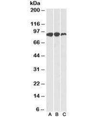 Western blot of human (A), mouse (B) and rat (C) adipose lysates with Aconitase 2 antibody at 0.1ug/ml. Predicted molecular weight: ~85kDa.