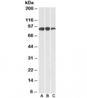 Western blot of human (A), mouse (B) and rat (C) adipose lysates with Aconitase 2 antibody at 0.1ug/ml. Predicted molecular weight: ~85kDa.