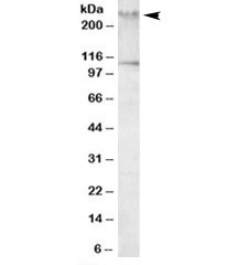 Western blot testing of human peripheral mononucleocytes lysate with Talin 1 antibody at 1ug/ml. The expected ~275kDa band and the additional ~110kDa band are blocked by the immunizing peptide.
