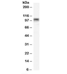 Western blot testing of rat stomach lysate with MYBL2 antibody at 0.1ug/ml. Predicted molecular weight: ~79kDa, routinely observed at 100~110kDa.