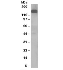 Western blot testing of human testis lysate with Dynactin antibody at 1ug/ml. Predicted molecular weight: ~142kDa.~