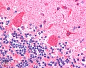 IHC staining of FFPE human cerebellum with Dynactin antibody at 2.5ug/ml. HIER: steamed with pH6 citrate buffer, AP-sta