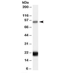 Western blot testing of human thyroid lysate with RASAL1 antibody at 0.3ug/ml. The expected ~90kDa band and the additional ~20kDa band both are blocked by the immunizing peptide.