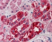 IHC staining of FFPE human kidney with MID2 antibody at 5ug/ml. HIER: steamed with pH6 citrate buffer, AP-staining.