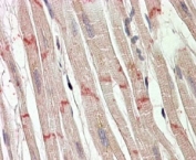 IHC testing of FFPE human heart with Desmoplakin antibody at 4ug/ml. HIER: steamed with pH6 citrate buffer, AP-staining. Cardiomuscular fiber junction staining seen.