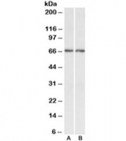 Western blot testing of human A) cerebellum and B) hippocampus lysate with Acetylcholinesterase antibody at 0.3ug/ml. Predicted molecular weight ~67kDa.
