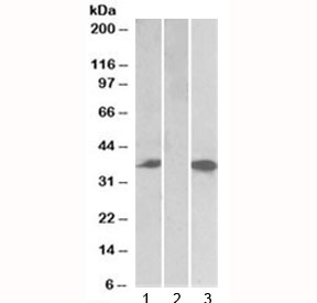 Western blot testing of HEK293 lysate overexpressing human Chymase-FLAG with Chymase antibody (0.1ug/ml) in Lane 1 and anti-FLAG (1/3000) in lane 3. Mock-transfected HEK293 probed with Chymase (0.5ug/ml) in Lane 2. Predicted molecular weight: ~35 kDa.